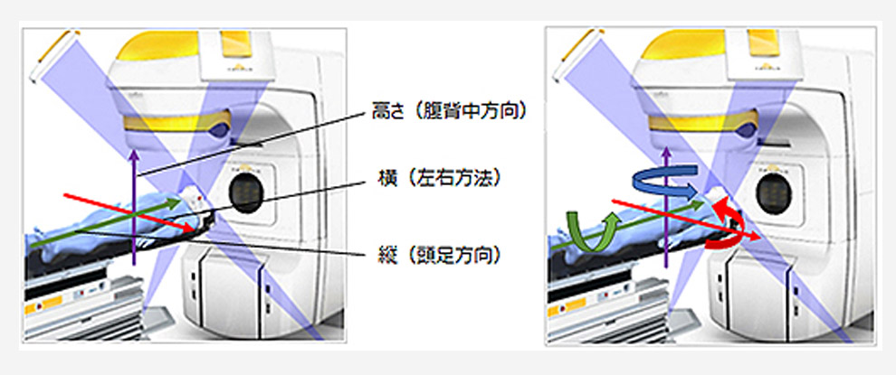 後頭部の形を成型します